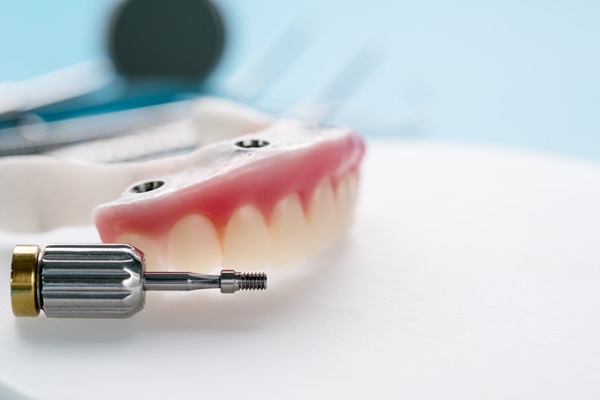 Implant Supported Dentures Can Solve The Problem Of Missing Teeth